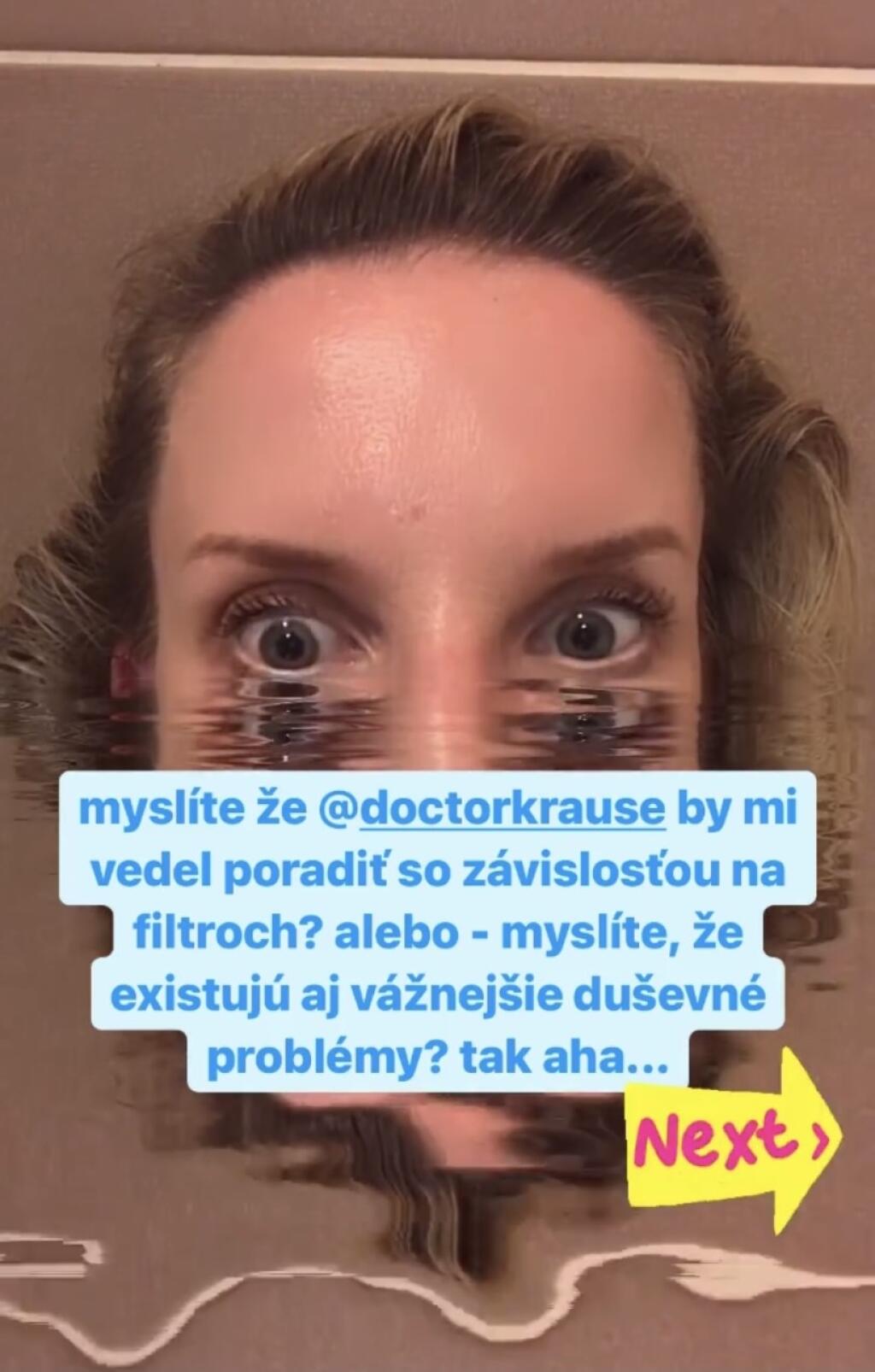 Adela Vinczeová je závislá na vtipných filtroch.