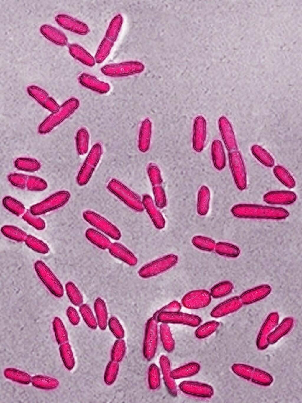 Listeria monocytogenes что это