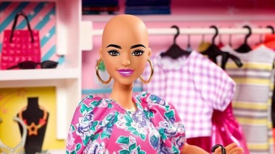 Barbie s ochorením alopecia