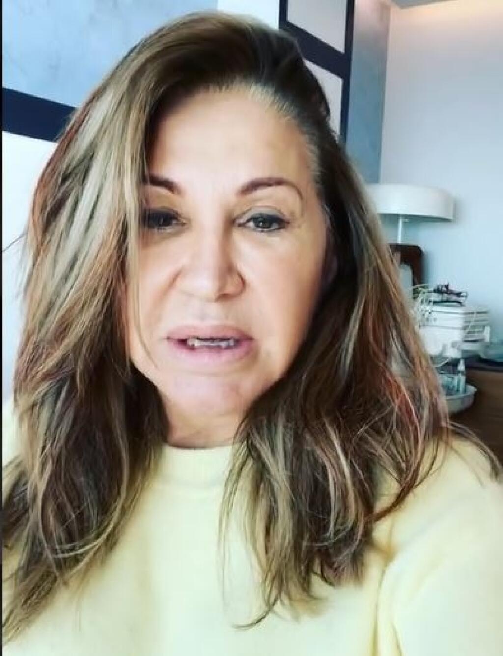 Na jej tvári sú viditeľné vrásky, pleť je ochabnutá a jej oči pôsobia opuchnuto. Milionárka bola pri tom už v minulosti kritizovaná za nadmerné používanie fotografických filtrov, ktorými si neuberala len vek, ale občas ak kilá navyše.