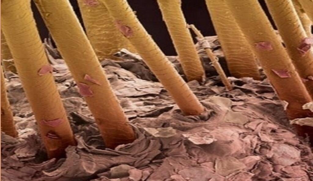 Фото под микроскопом под ногтями