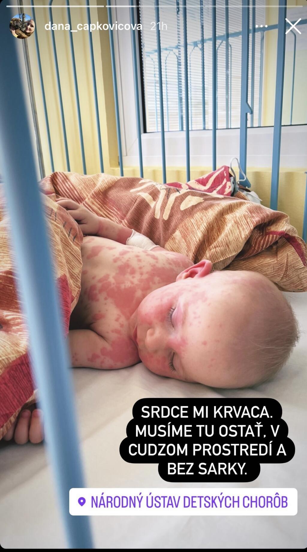 Moderátorkin synček má červené fľaky po celom tele.