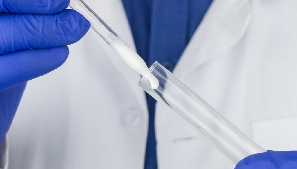 Medical,Laboratory,Assistant,Checks,A,Test,Tube,With,Sperm.,Spermogram.