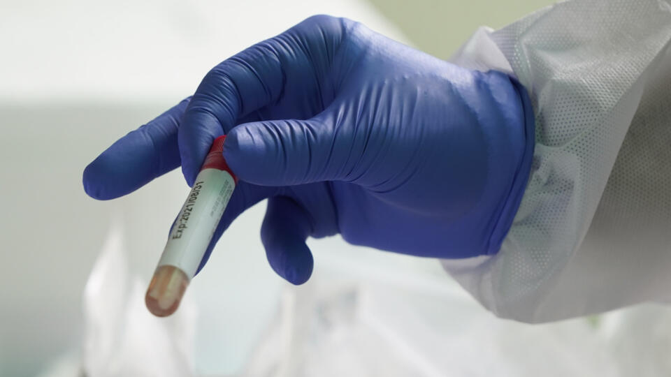 MIK 5 Kuala Lumpur - Zdravotníík drží testovaciu banku na testy na koronavírus v nemocnici  KPJ Damansara Specialist Hospital v Petaling Jaya v Malajzii 30. marca 2020. FOTO TASR/AP


A health worker holds a testing tube after conducing at a drive-through COVID-19 test at KPJ Damansara Specialist Hospital, in Petaling Jaya, Malaysia, Monday, March 30, 2020. The Malaysian government issued a restricted movement order to the public till April 14, to help curb the spread of the new coronavirus. The