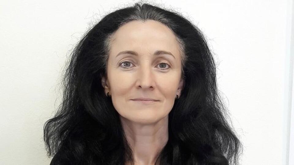 Oľga (51) pred zmenou.