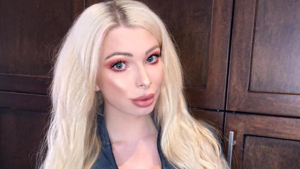 Má iba 23 rokov a množstvo plastických operácií: Chcela byť ako Marilyn Monroe, no je ako...Fú!