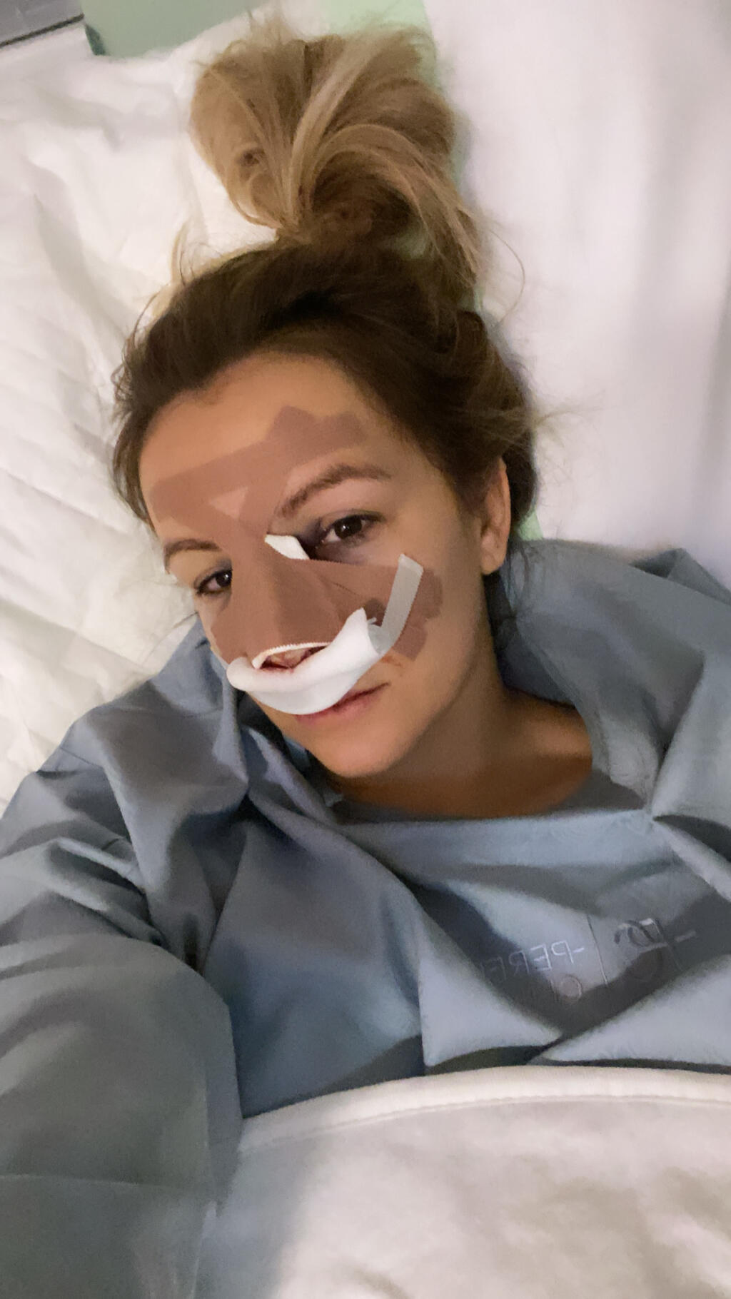 Známa česká športová influencerka Šárka Peková, ktorá navštevuje aj zápasy Fortuna ligy podstúpila pred niekoľkými dňami operačný zákrok.