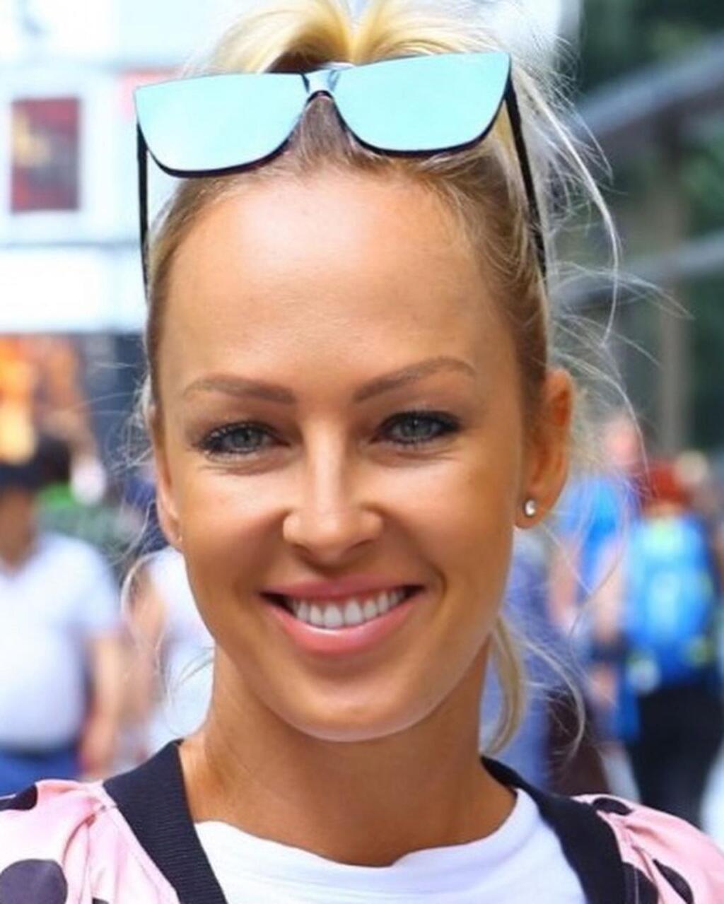 Zuzka Belohorcová po plastike.