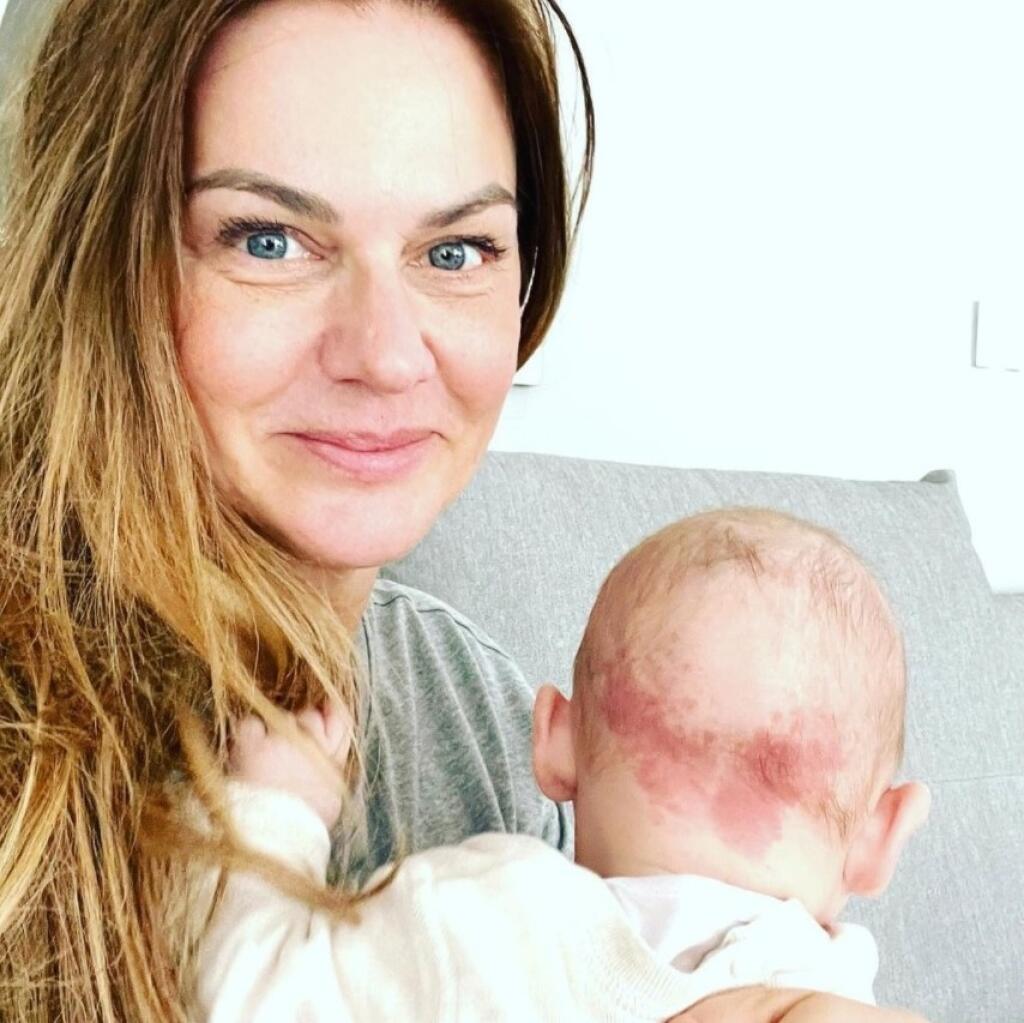 Lea má na hlávke motýlika.