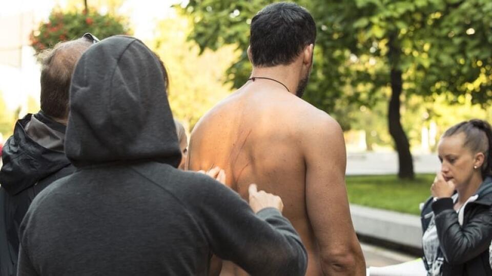 Šikovná maskérka vie vytvoriť jazvy ako od pravej šelmy.