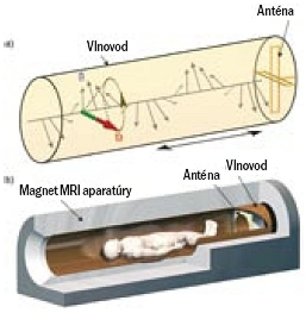 Magnetická rezonancia bez klaustrofóbie