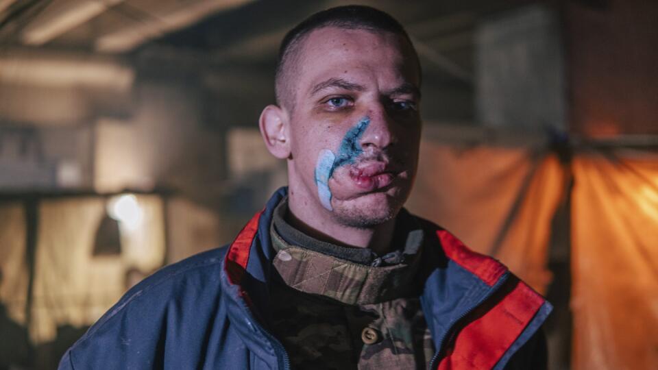 KK19 Mariupol - Na snímke, ktorú poskytol pluk Azov Národnej gardy Ukrajiny, príslušník ukrajinskej jednotky špeciálneho určenia Azov, zranený počas bojov protu ruským jednotkám, pózuje fotografovi v oceliarni Azovstaľ 10. mája 2022 v Mariupole. FOTO TASR/AP
In this photo provided by Azov Special Forces Regiment of the Ukrainian National Guard Press Office, an Azov Special Forces Regiment's serviceman, injured during fighting against Russian forces, poses for a photographer inside the Azovstal s