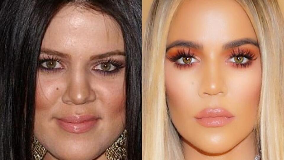 Khloe podstúpila obrovskú premenu. Napriek množstvu zákrokovpotrebuje na dokonalú fotografiu retuš.