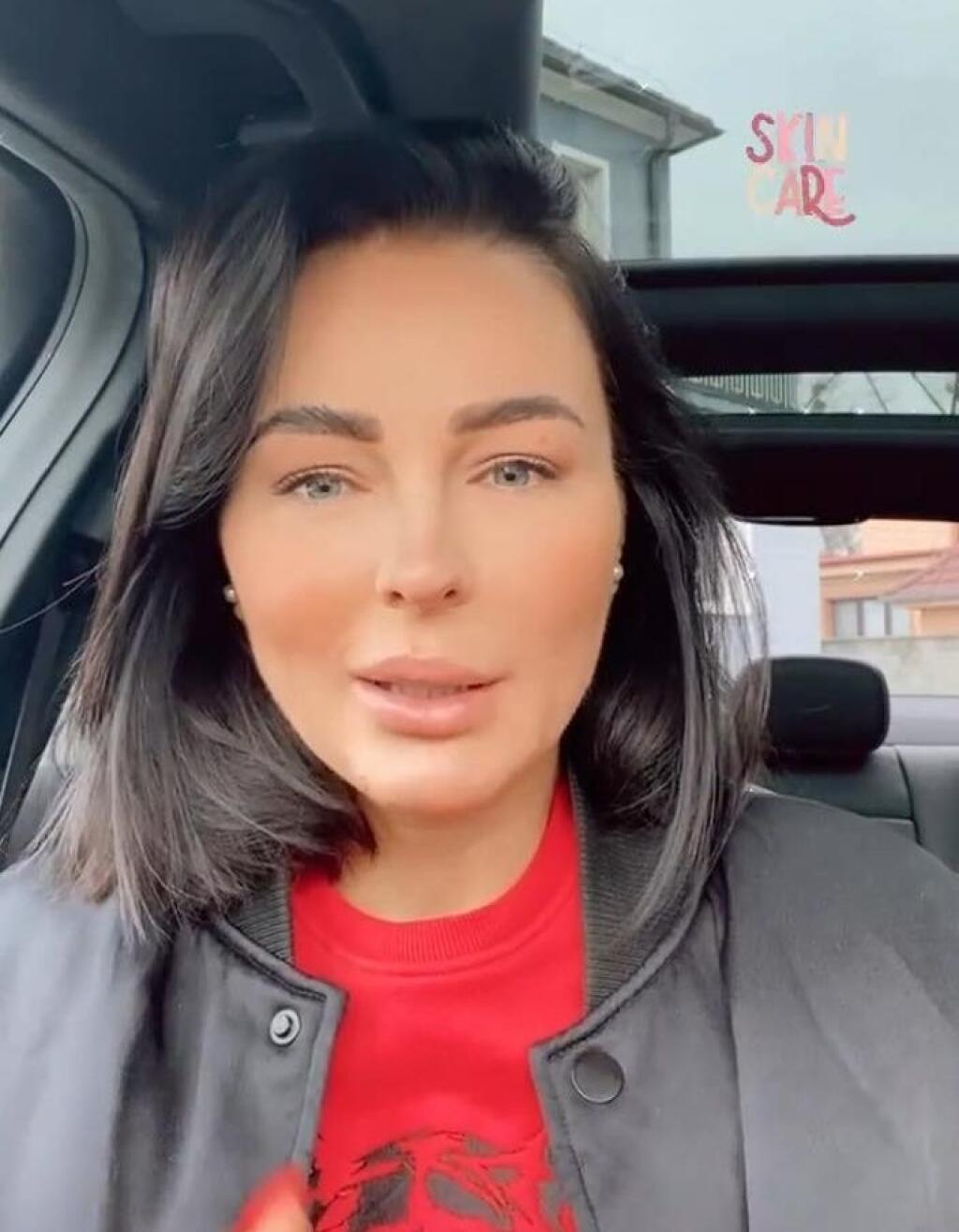 Na pravidelnú korekciu tváre chodí na estetickú kliniku aj Kristína Kormúthová.